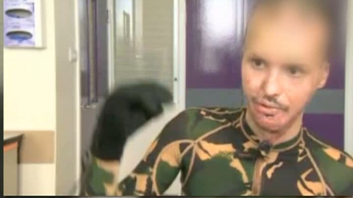 Viaţa după Colectiv. Mărturii tulburătoare, de la un tânăr român internat în Marea Britanie