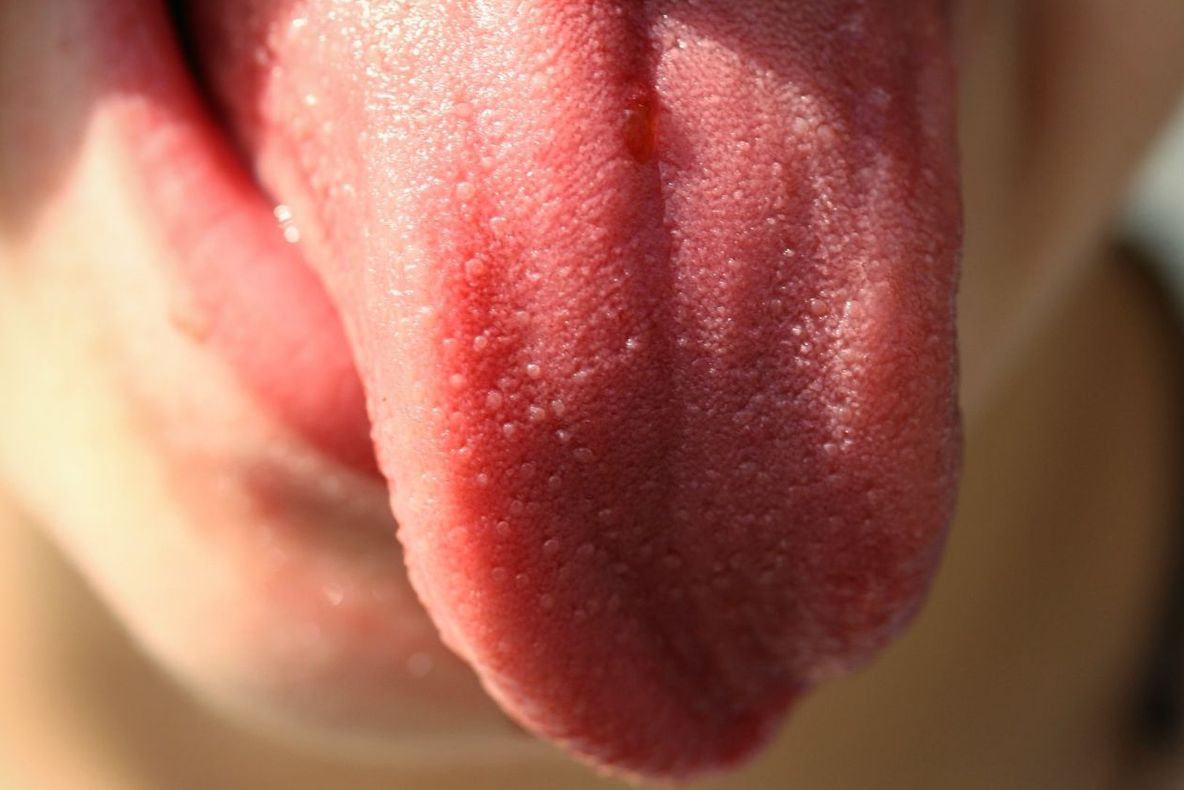 Ce dezvăluie limba despre sănătatea ta