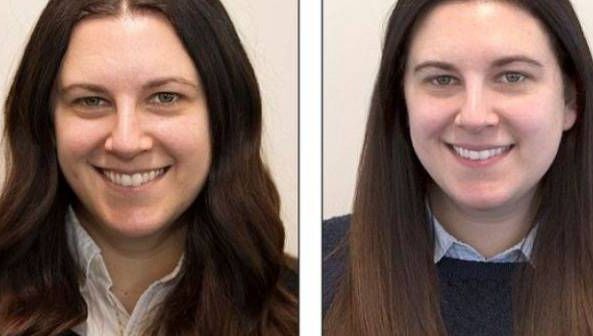 Nu s-a spălat timp de o lună pe faţă! Cum arată tenul ei 