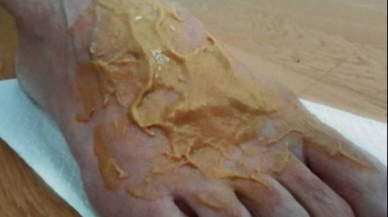 Și-a uns picioarele cu muștar și le-a băgat în șosete. Rezultatul? Peste așteptări