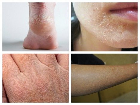 Cum îţi dai seama că suferi de o boală. Vezi indiciile