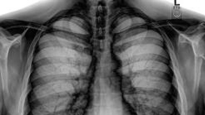 Adevărul despre radiografii. Ce se întâmplă, de fapt, când razele X intră în organismul nostru