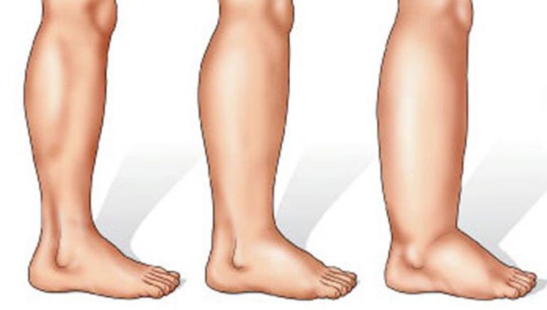 Trucuri care te ajută să previi retenţia de apă