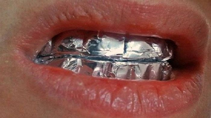 O brunetă focoasă şi-a pus staniol pe dinţi. Apoi, a adormit. Când s-a trezit, a rămas ULUITĂ