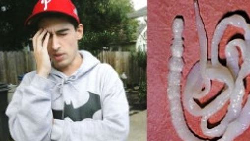 Avea o durere cumplită de cap. Medicii au încremenit când i-au scos asta din creier!