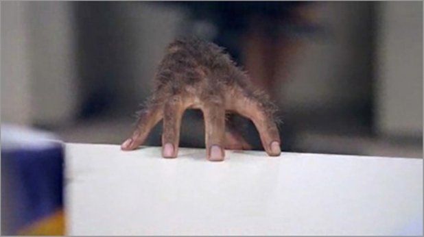 I se spune „copilul-vârcolac”. Unii fug de el, alții îl divinizează. Cum arată băiatul