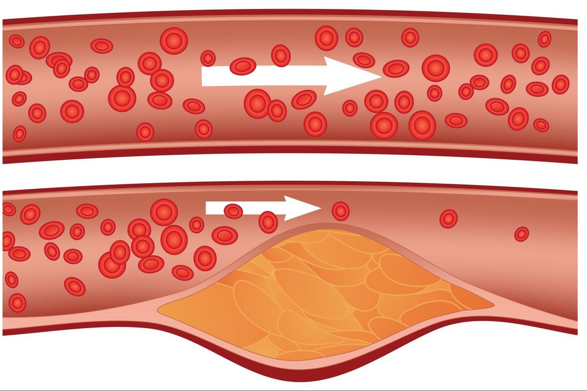 Remediul german străvechi care scade colesterolul 