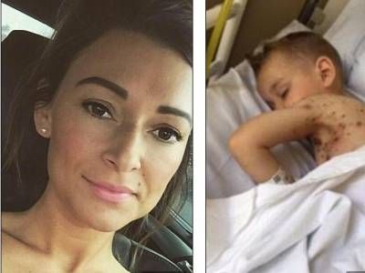 Atenţie! Copil la un pas de moarte, după ce i-a fost prescris ibuprofen pentru vărsat de vânt