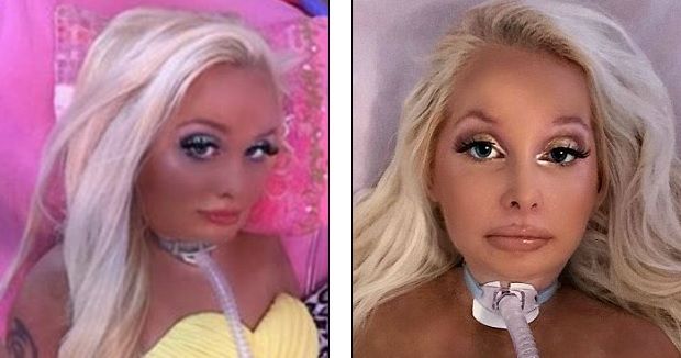 E paralizată de la gât în jos, dar se încăpățânează să devină o păpușă vie. A cheltuit deja 15000 $