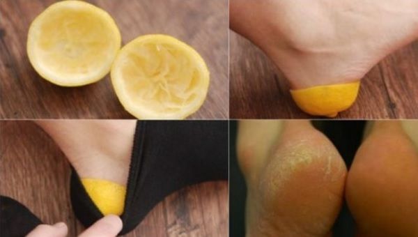 Cum să vindeci călcâiele crăpate cu ajutorul unei lămâi