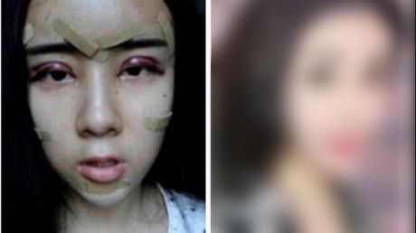 Are 15 ani și a apelat la operații estetice ca să-și recâștige iubitul. E incredibil cum arată acum