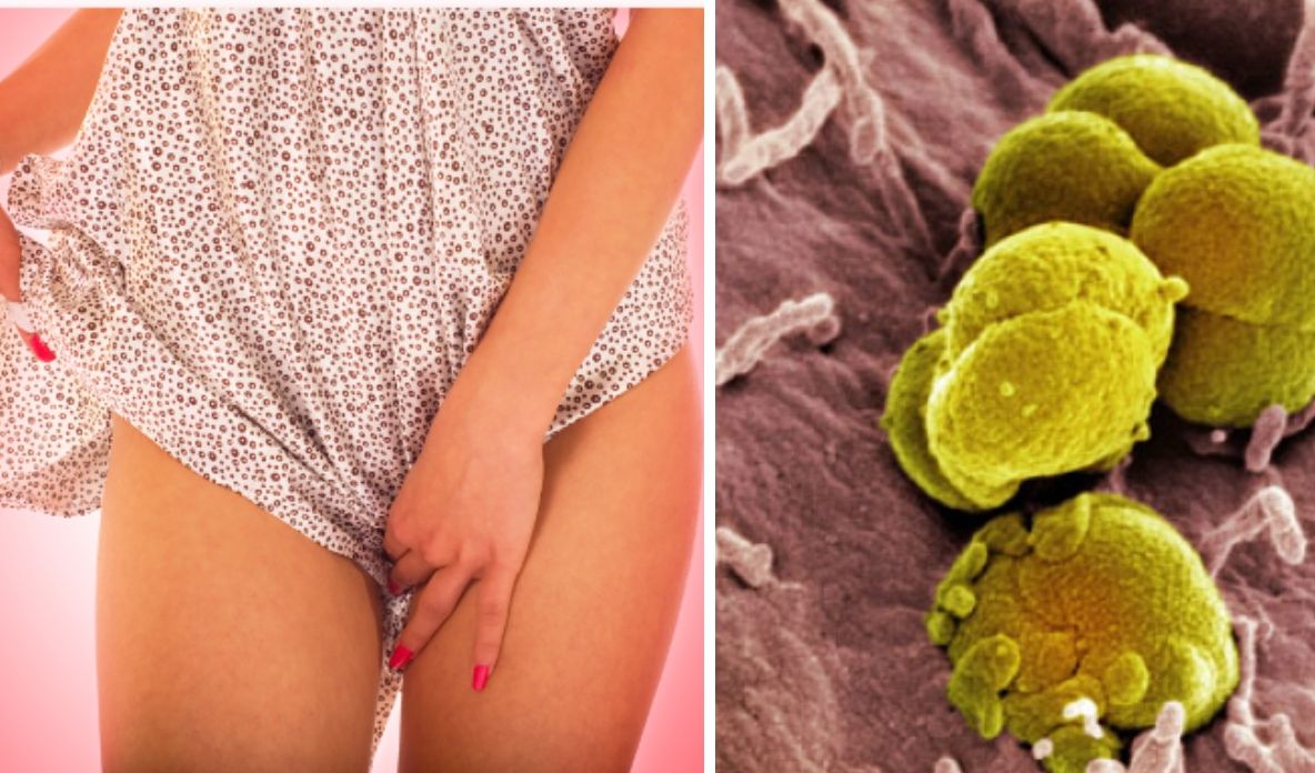 O boală sexuală a devenit imună la antibiotice și face ravagii. Cât de mare este pericolul
