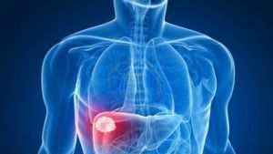 Cum ne detoxifiem ficatul după Paşte? Acesta este cel mai simplu remediu natural