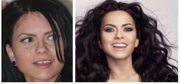 Cum arătau divele din România înainte să-și repare dantura. Vei rămâne surprins!