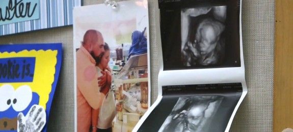 Caz extrem de rar. O femeie a devenit mamă de două ori la distanţă de 38 de zile