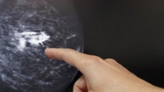 Avea un semn ciudat pe sânul stâng. S-a dus la doctor şi iată ce a descoperit!