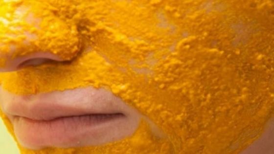 Avea o acnee severă și nu știa ce să facă. Până când s-a dat pe față cu asta. Efect imediat