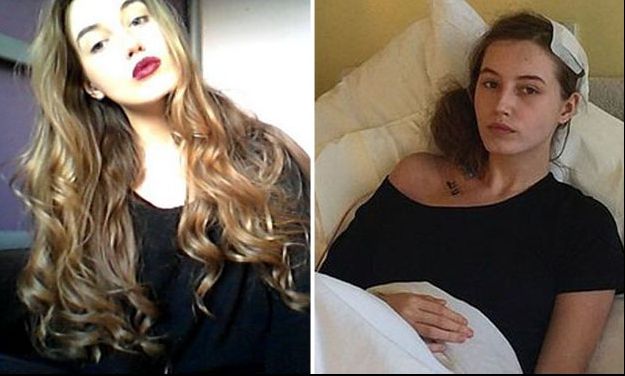 S-a trezit în timpul unei operații pe creier. Cuvintele ei au fost... Medicii sunt îngroziți!