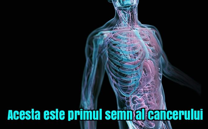 Nu ignorați! Acesta este primul semn al cancerului! 