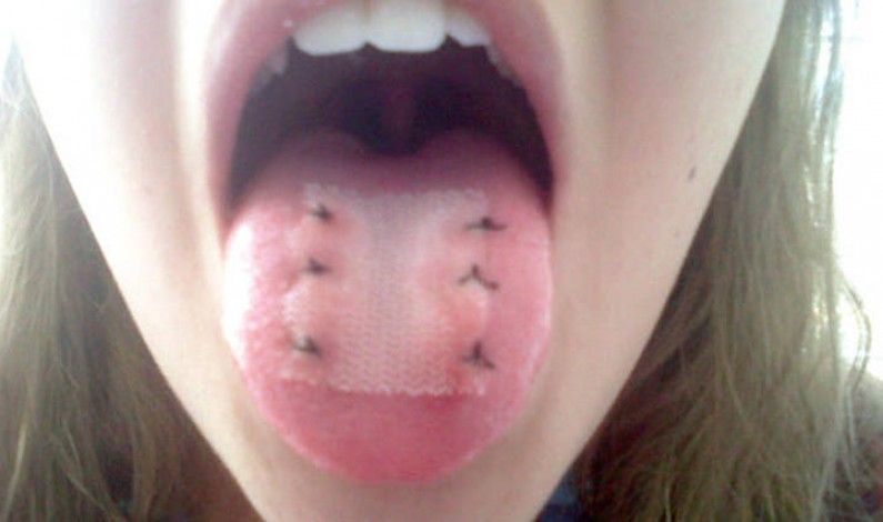 Plasture pe limbă? Atenție la trucurile de slăbit - Topul celor mai tâmpite diete