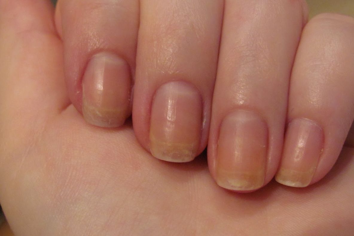 Cea mai simplă soluţie pentru unghiile îngălbenite. Scapă de această problemă cu un produs banal