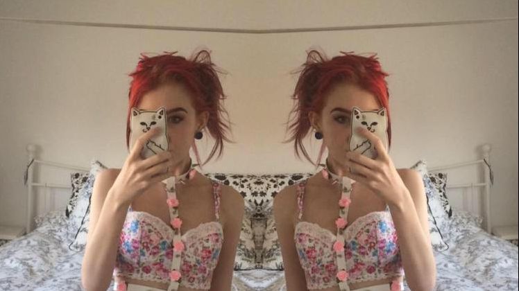 Boala a obligat-o să își scoată mușchii coapselor. Cum arată acum. E o adevărată dramă pentru ea!