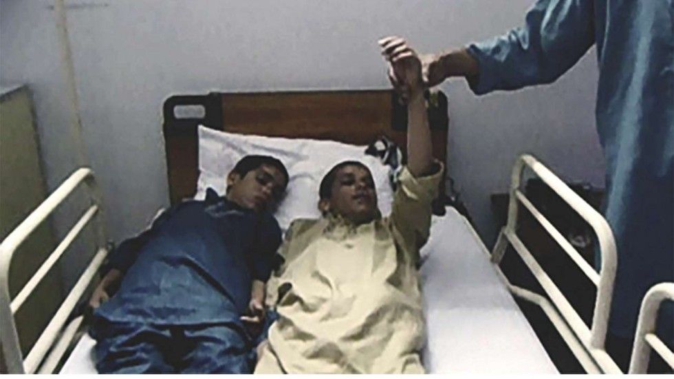 Doi fraţi din Pakistan i-au şocat pe toţi medicii. Cad seceraţi în fiecare zi când dispare Soarele