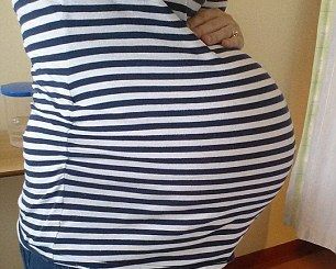 S-a chinuit 12 ore să nască. Când a venit bebelușul pe lume, medicii au rămas șocați. Așa ceva...