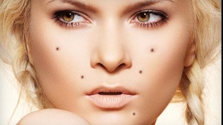 Ai alunițe în aceste puncte de pe corp? Care este semnificația