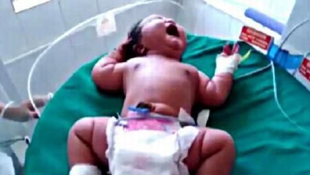 Record. Cât cântăreşte fetiţa cu cea mai mare greutate la naştere din lume