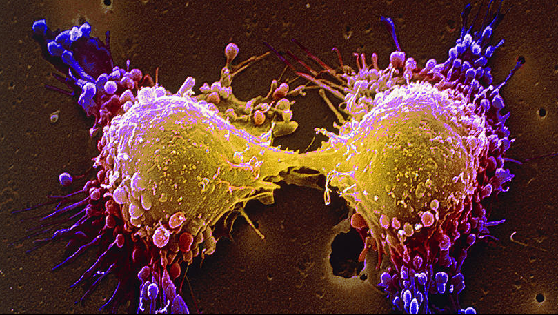 Cele mai mari mituri despre cancer