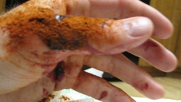 Genial! Cum să opreşti orice sângerare în doar 10 secunde!