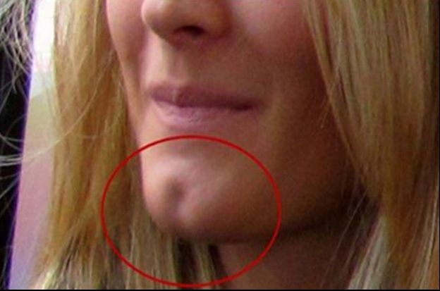 Ce se spune despre persoanele care au gropițe în bărbie