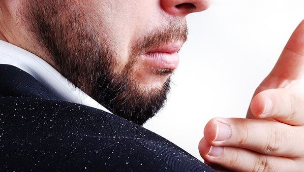 Ai mătreaţă? Poate fi semnul unei probleme mai serioase decât crezi. Fă-ţi analizele!