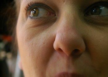 Ce spune pielea feţei despre sănătatea ta