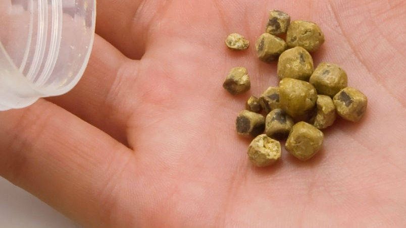 Dietă care te ajută să elimini pietrele la fiere. Efectele sunt uimitoare