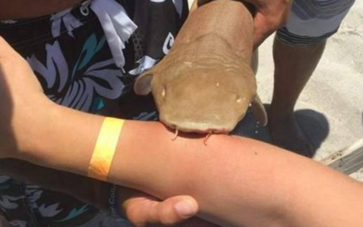 O femeie a fost dusă la spital cu un rechin prins de braţul ei
