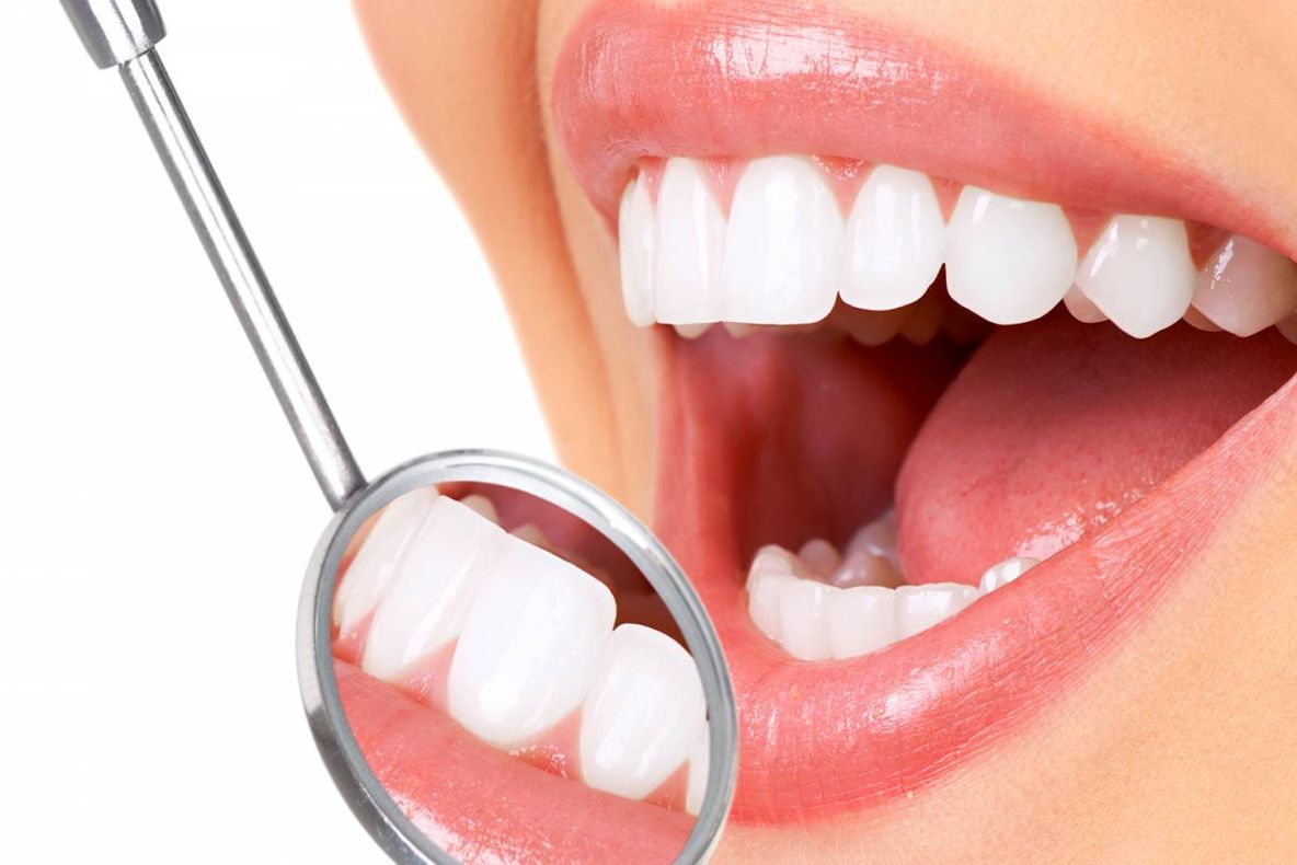 Vrei să ai dinți ”de Hollywood”? Procedura greșită poate să-ți distrugă dantura. Ce să faci