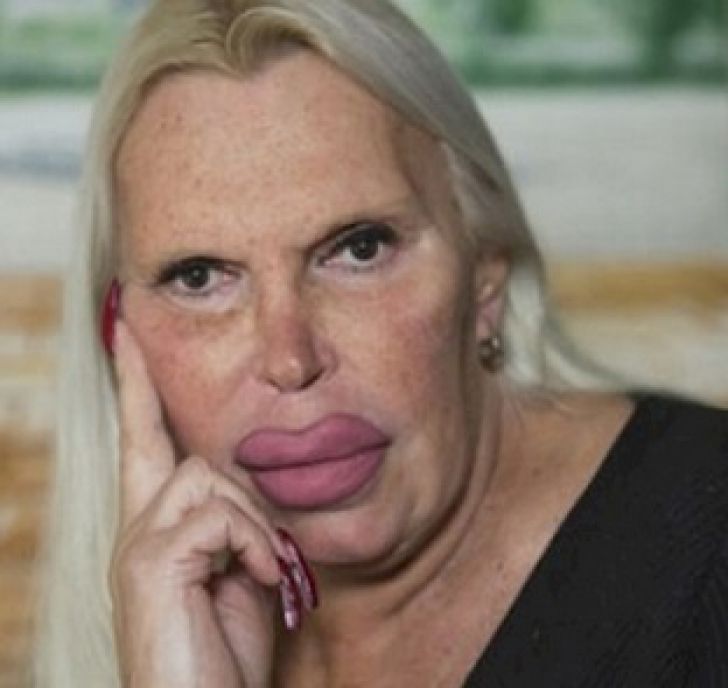 A cheltuit o avere pentru a arăta "perfect". AŞA este azi. Cum arăta ÎNAINTE? Te trec fiorii...