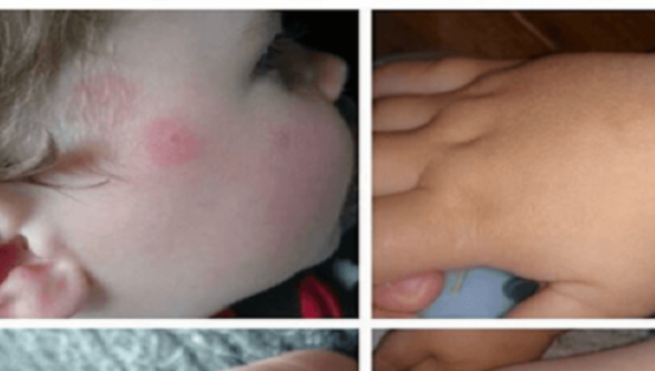 A descoperit aceste semne ciudate pe corpul fiului său! Informaţia aceasta îţi poate salva copilul!