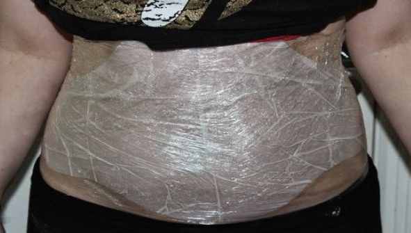 A pierdut aproape 2 cm din circumferinţa taliei într-o singură noapte. Cum este posibil