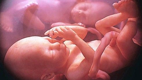 Un copil l-a purtat pe fratele său geamăn în pântece timp de 15 ani. Ce au decis medicii