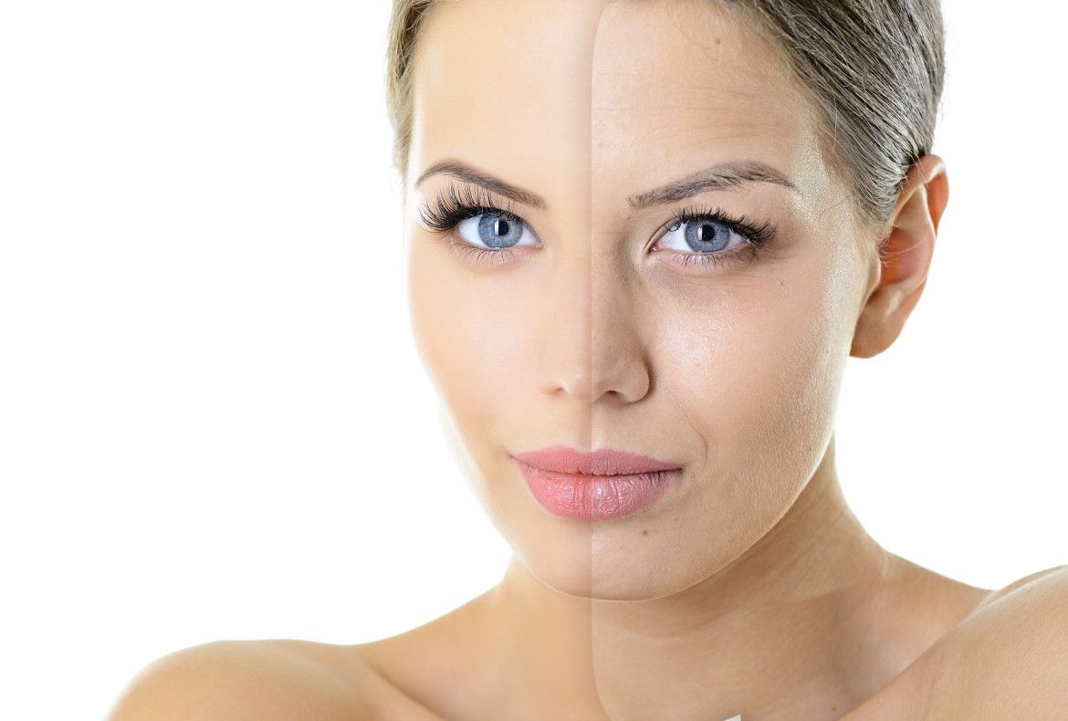 Metodă extremă de îndepărtare a cearcănelor. E nebunie curată!