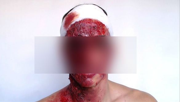 Campion român, desfigurat de soţie