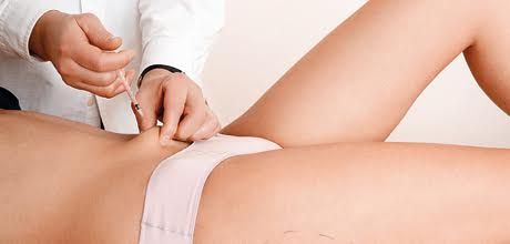 Lipoliza, tratamentul revoluţionar care topeşte celulita!