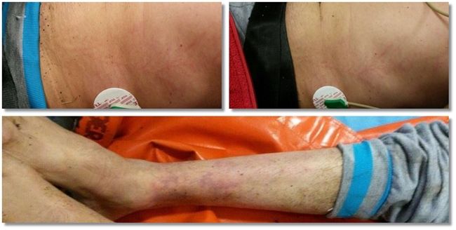 Ce au păţit doi bărbaţi care s-au adăpostit de furtună, în Timiş. Unul dintre ei n-a supravieţuit