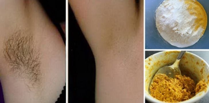 Cum să scapi de părul de la subraţ. Definitiv!