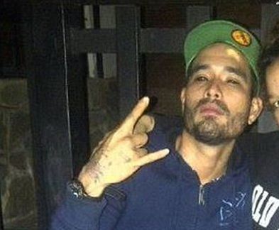 Și-a tăiat nasul ca să arate ca un personaj din benzile desenate. Transformarea lui e horror