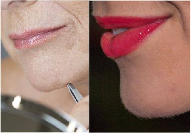 Eşti femeie şi ţi-au apărut fire de păr în barbă? Ce boală serioasă înseamnă