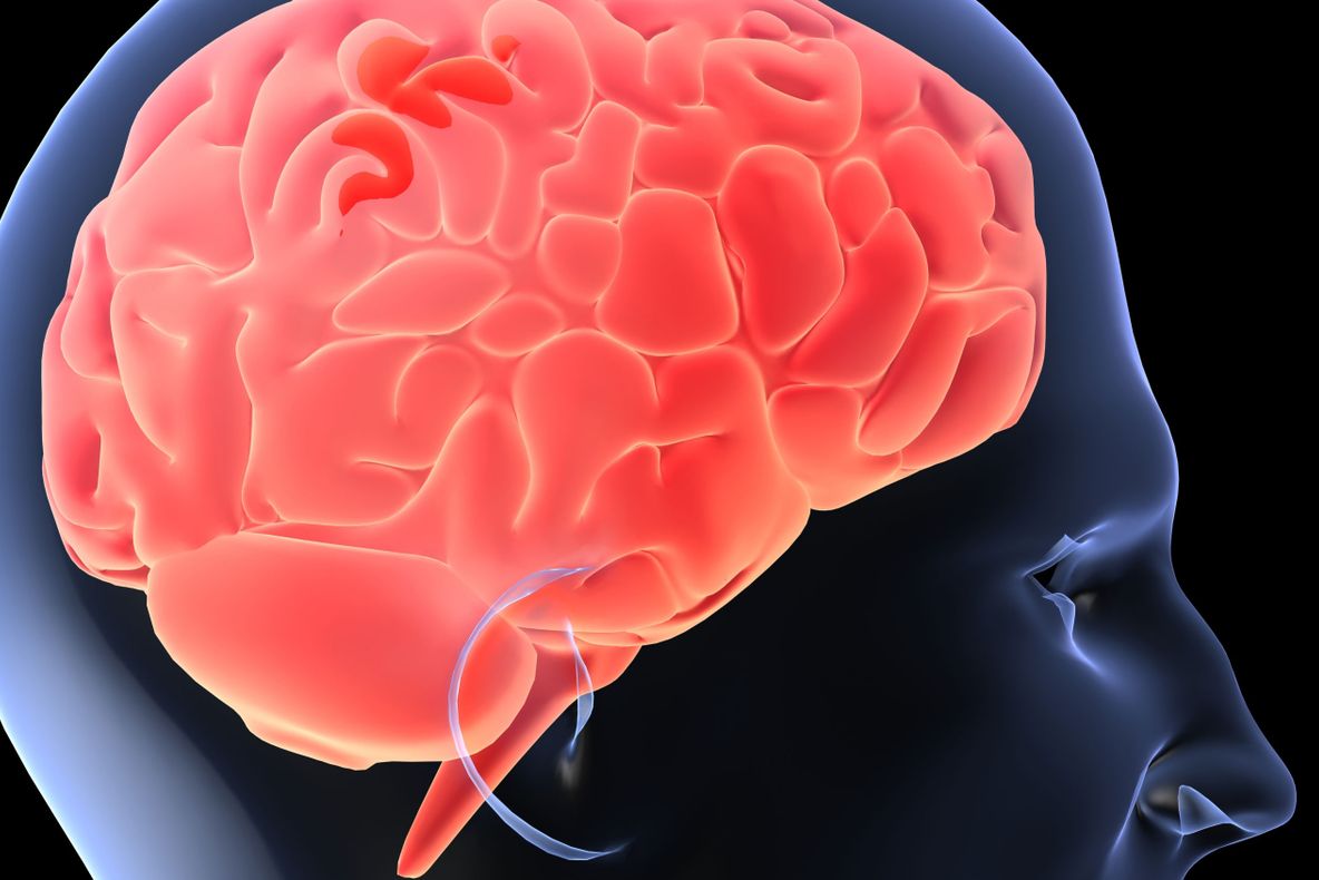 Atenţie! Acest aliment te predispune la paraziţi pe creier!